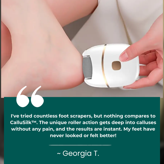 CalluSilk™ - Foot Callus Remover