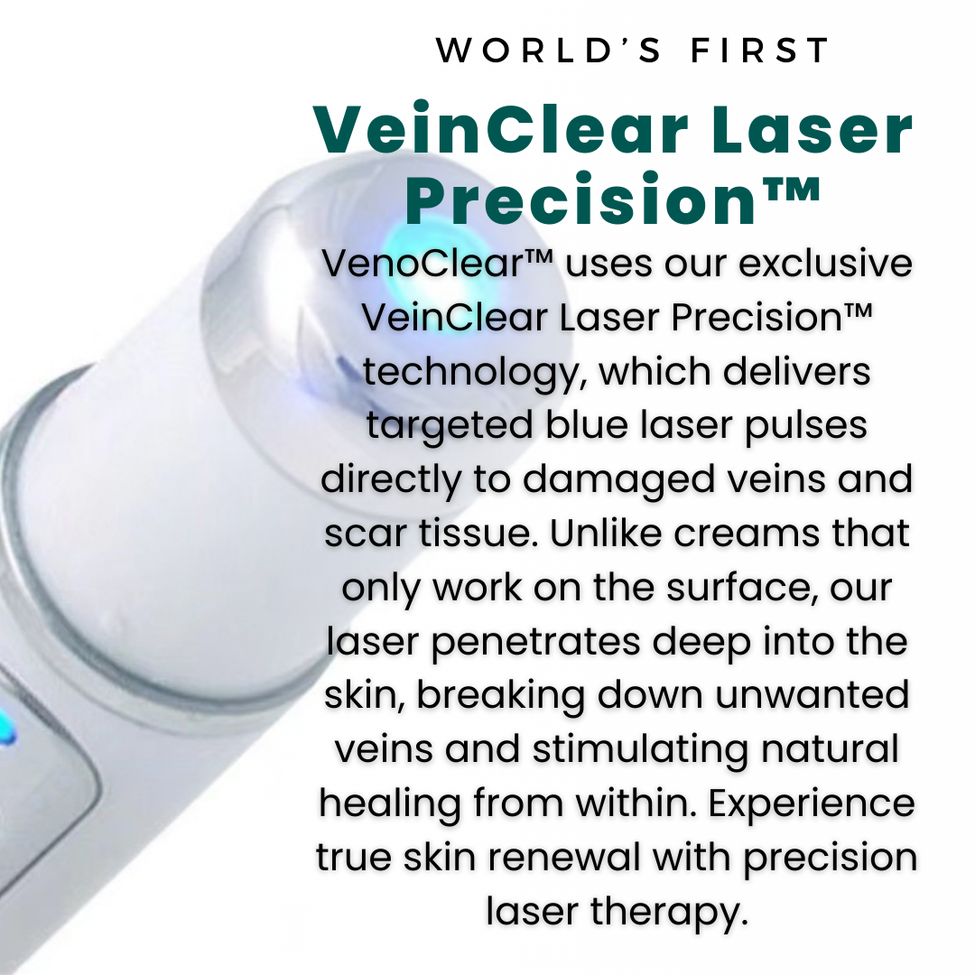 VenoClear™ Varicose Veins Treatment