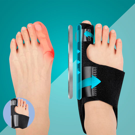 AlignFlex™ Bunion Corrector