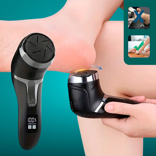 SmoothStride™ Foot Callus Remover