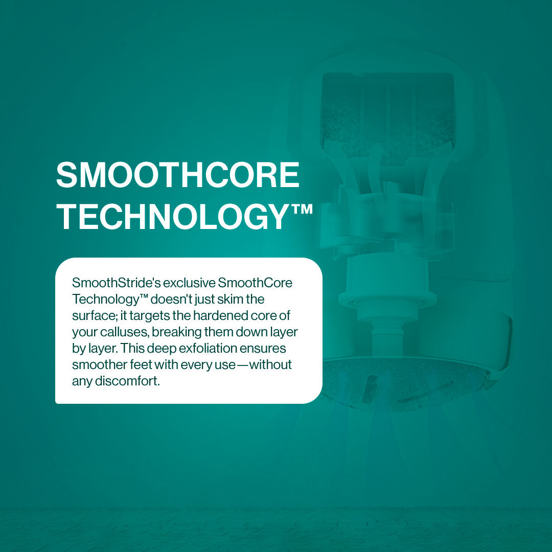 SmoothStride™ Foot Callus Remover